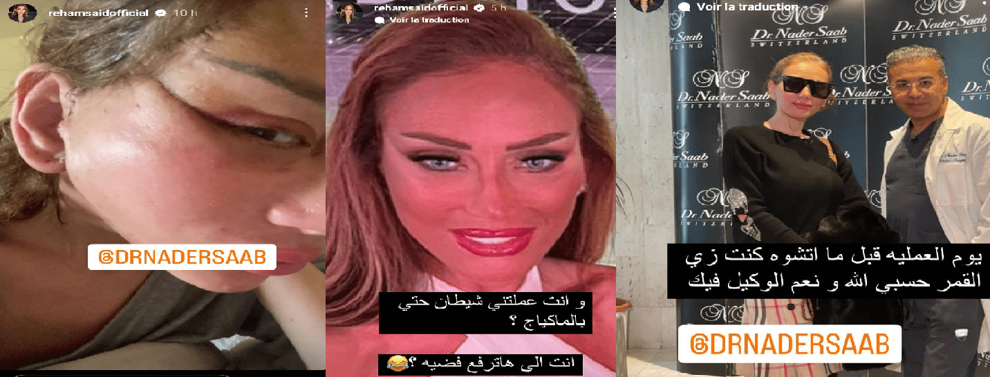 ريهام سعيد قبل وبعد التجميل| مواقع التواصل