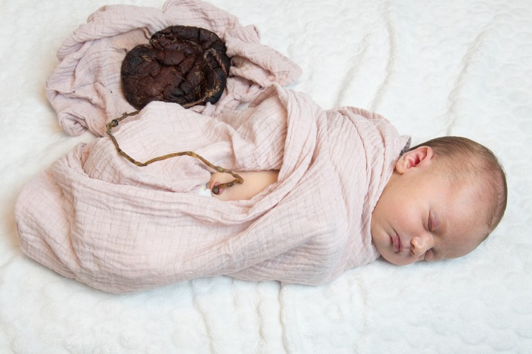 Newborn baby with placenta still connected to baby after 6 days. Photo of placenta dried and treated with herbs for lotus birth. Select focus.; Shutterstock ID 2256761803; purchase_order: AJA; job: ; client: ; other:
