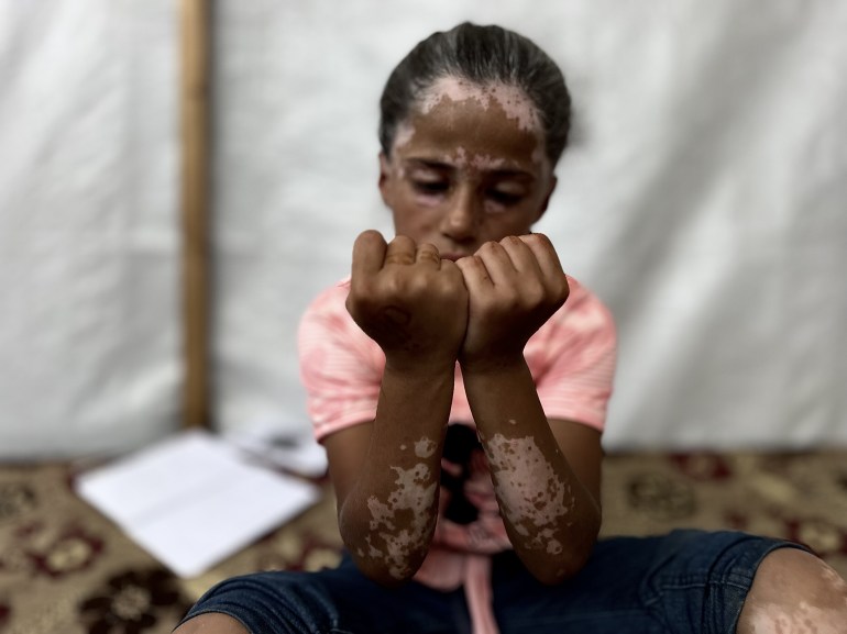 لانا.. طفلة فلسطينية شيبتها الإبادة الإسرائيلية لانا.. طفلة فلسطينية شيبتها الإبادة الإسرائيلية