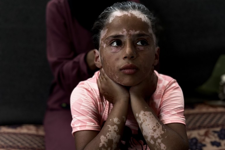 لانا.. طفلة فلسطينية شيبتها الإبادة الإسرائيلية لانا.. طفلة فلسطينية شيبتها الإبادة الإسرائيلية