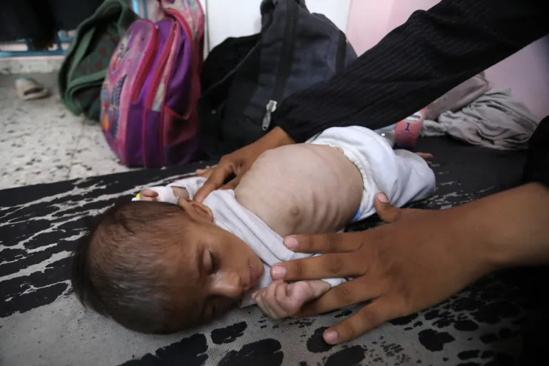 شهداء التجويع في غزة