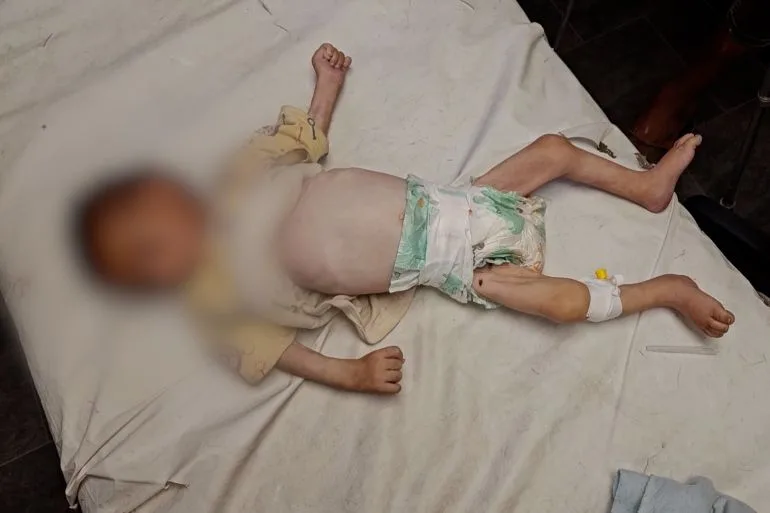 أمنستي: تجويع غزة سياسة إسرائيلية ممنهجة وجريمة حرب تتطلب تحركا دوليا عاجلا تجويع غزة