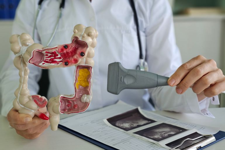 الموجات فوق الصوتية تمنح الأمل بعلاجات دقيقة للسرطان upload image