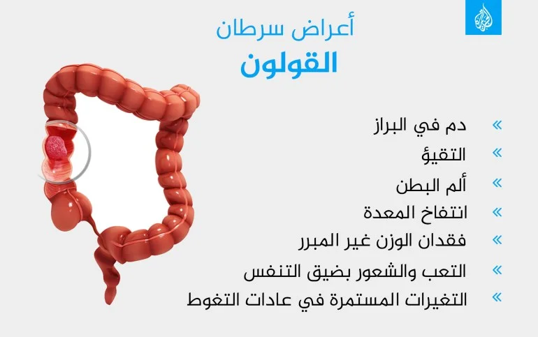 مواليد 1990 أكثر عرضة للإصابة بسرطانات الجهاز الهضمي فما السبب؟