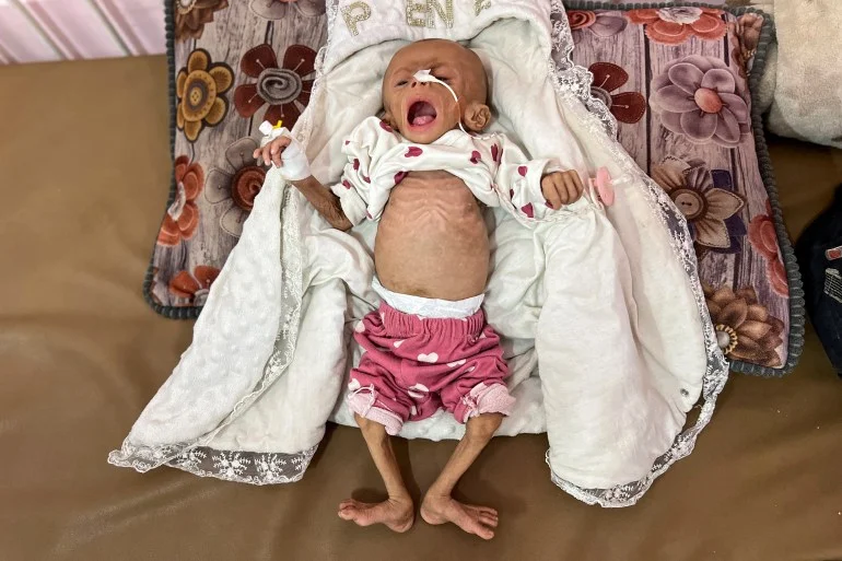 بالصور.. سكان غزة يموتون جوعا