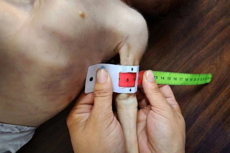 أطفال غزة بين الموت جوعا وأكل الرمال أطفال غزة بين الموت جوعا وأكل الرمال