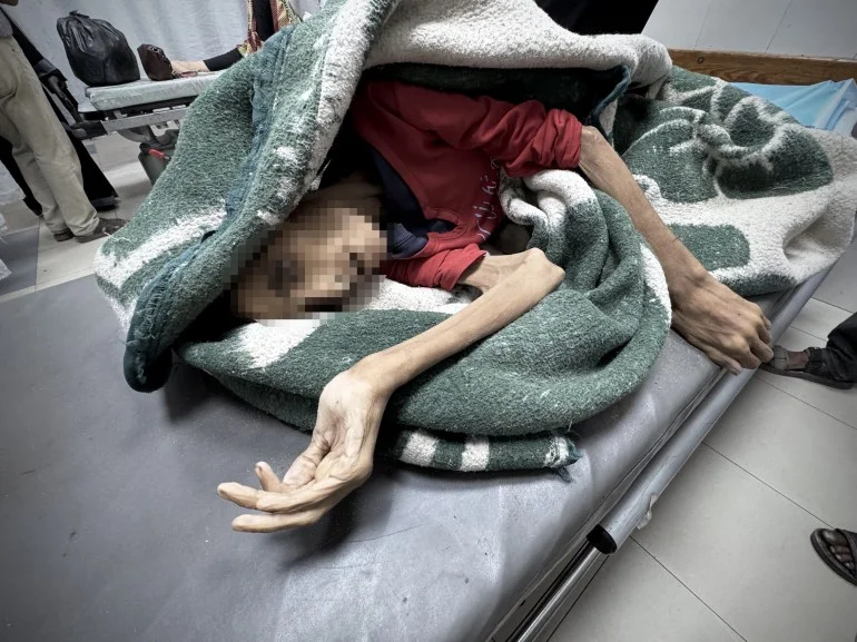 الشابة رحيل.. ضحية جديدة للاحتلال والتجويع في غزة الشابة رحيل.. ضحية جديدة للاحتلال والتجويع في غزة