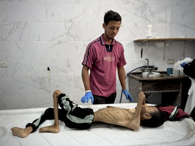 بالصور.. الجوع يفتك بأطفال غزة والعالم يتفرّج بالصور.. الجوع يفتك بأطفال غزة والعالم يتفرّج