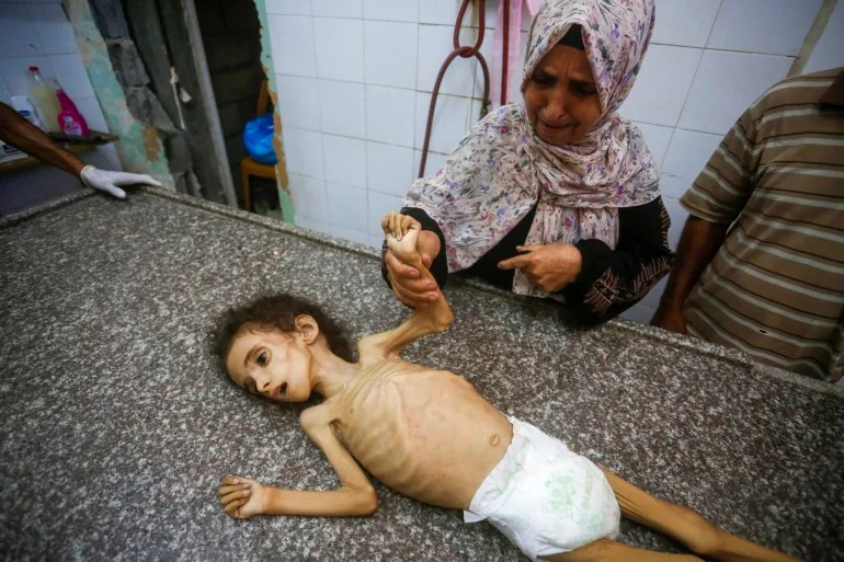 بالصور.. الجوع يفتك بأطفال غزة والعالم يتفرّج بالصور.. الجوع يفتك بأطفال غزة والعالم يتفرّج