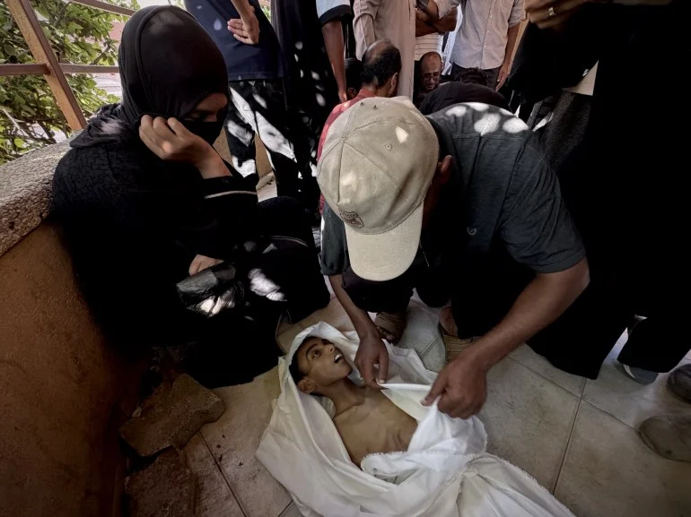 بالصور.. الجوع يفتك بأطفال غزة والعالم يتفرّج بالصور.. الجوع يفتك بأطفال غزة والعالم يتفرّج