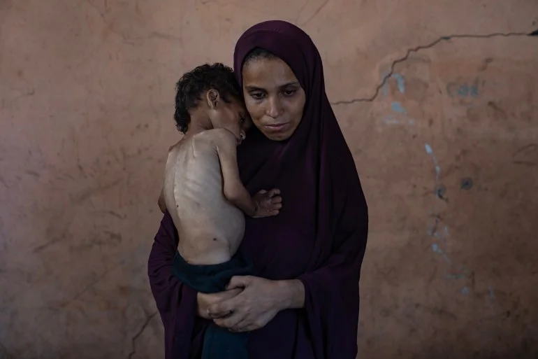 بالصور.. الجوع يفتك بأطفال غزة والعالم يتفرّج بالصور.. الجوع يفتك بأطفال غزة والعالم يتفرّج