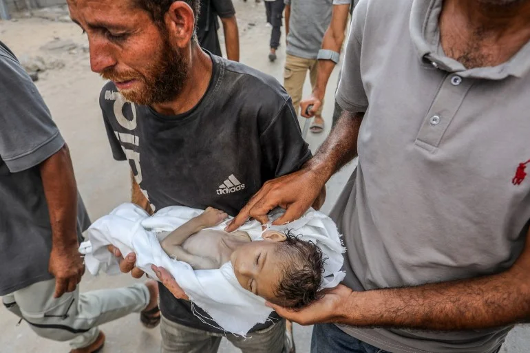 بالصور.. الجوع يفتك بأطفال غزة والعالم يتفرّج بالصور.. الجوع يفتك بأطفال غزة والعالم يتفرّج