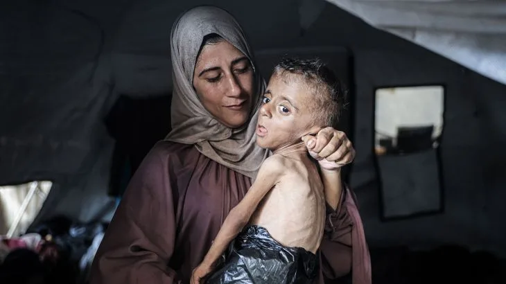 المجاعة في غزة