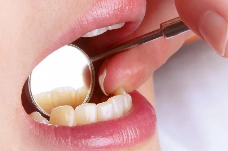 ما سبب الشعور بألم الأسنان عند الإصابة بنزلة برد؟