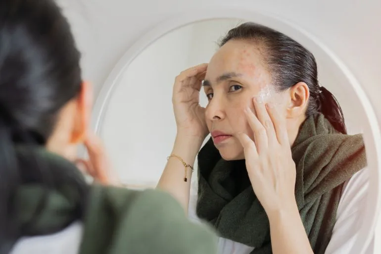 خبراء يحذرون.. مواد عليكِ تجنبها في منتجات العناية بالشعر والبشرة مواد عليكِ تجنبها