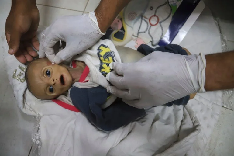 عامٌ من الجوع.. خط زمني لمعاناة غزة بين الحصار وتضاؤل المساعدات في 2025